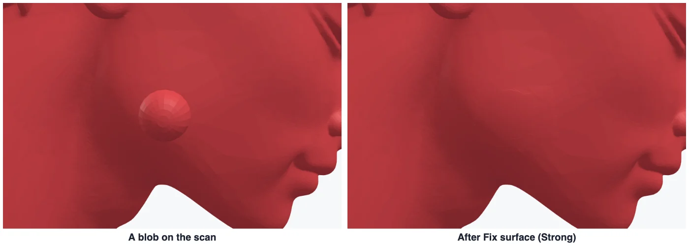 A blob on the cheek of a 3D scanned relief, and the same cheek after Fix surface, smooth